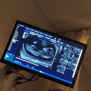 Meet your Posher, Emerson